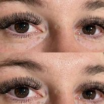 Eyes Facing